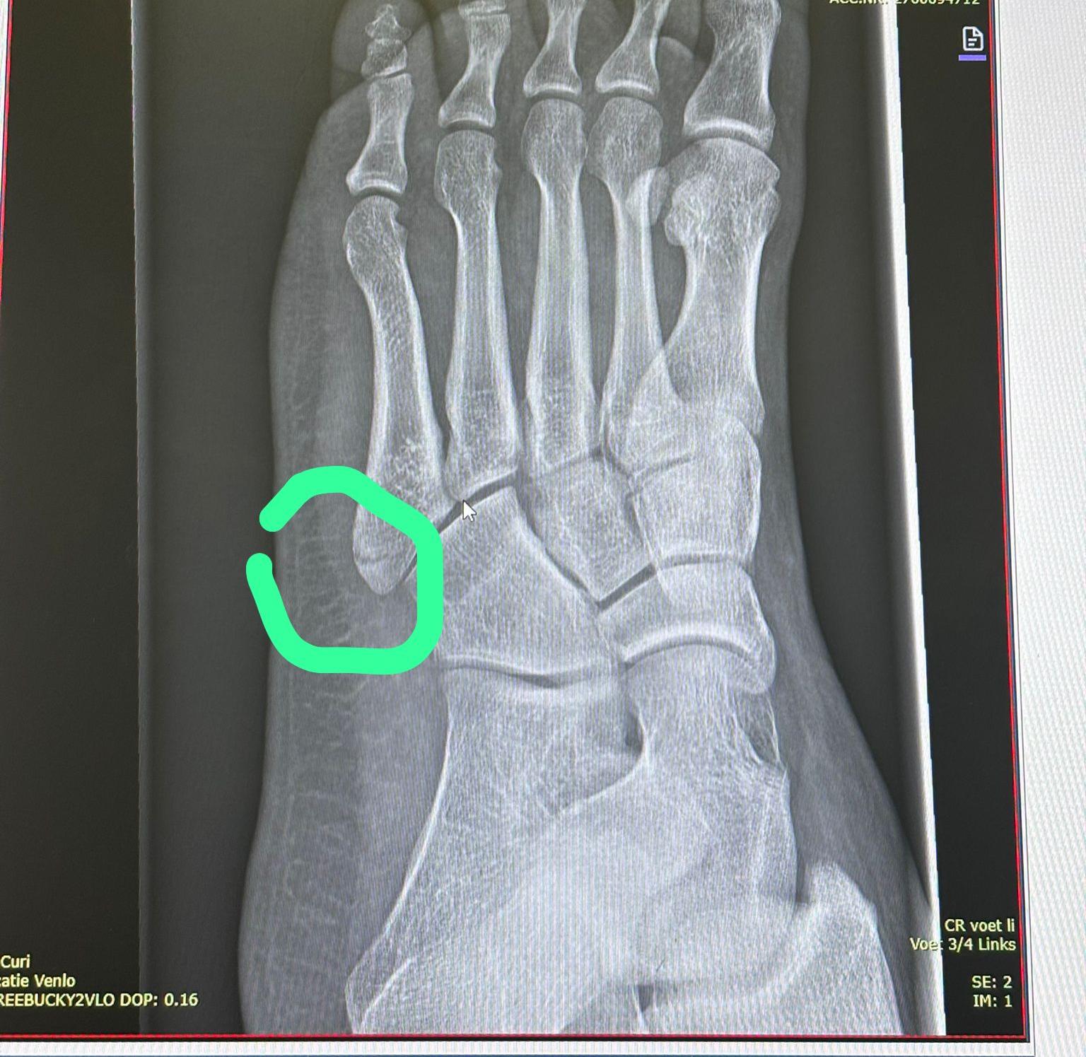 Een 'Been'-derend Uitzicht